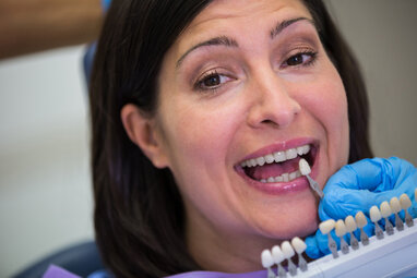 Carillas dentales de cerámica sobre piezas anteriores